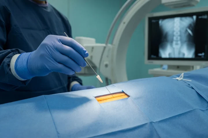 Infiltração facetária na coluna lombar com apoio de radioscopia