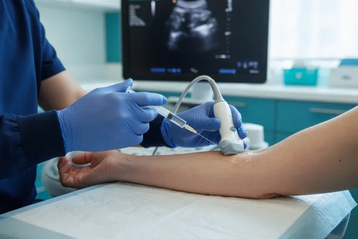 Proloterapia em tendão do cotovelo guiada por ultrassom